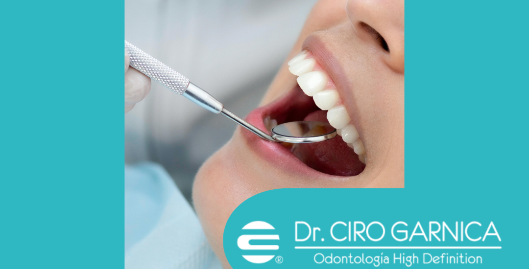 Diseño 'Opinión' - Página web