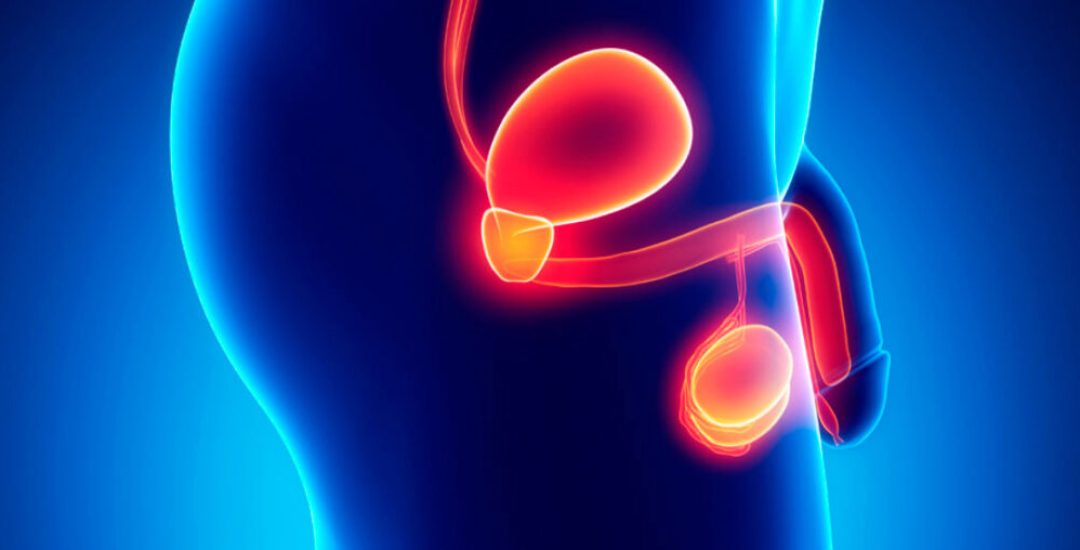 sintomas-comunes-cancer-prostata